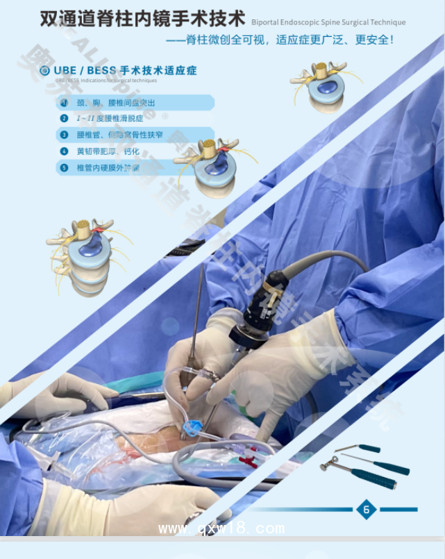 UBE單側雙通道脊柱微創(chuàng)手術相比其他手術方式