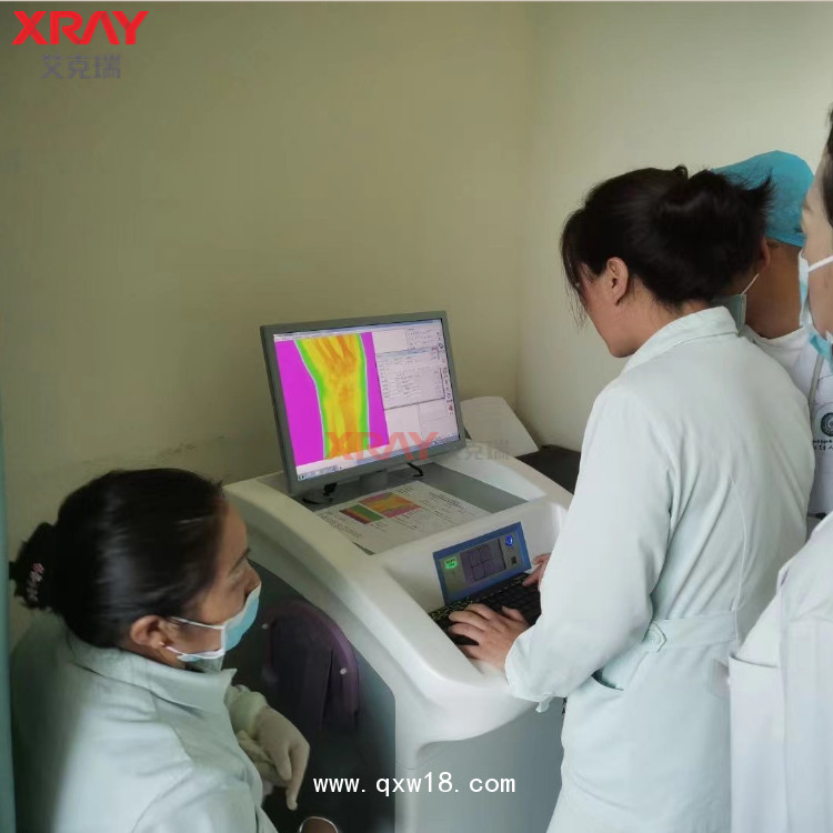 骨密度測試儀 艾克瑞Osteo檢測儀 用于成人骨質(zhì)檢測