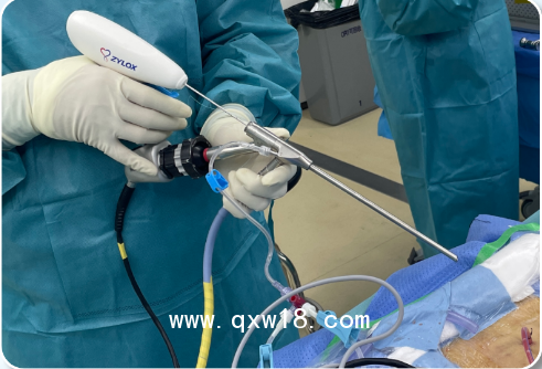 UBE專用骨科一次性纖維環(huán)縫合器