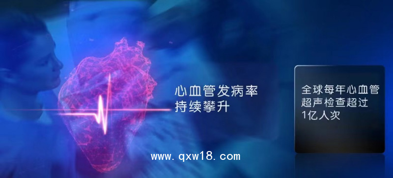 彩色多普勒超聲診斷儀