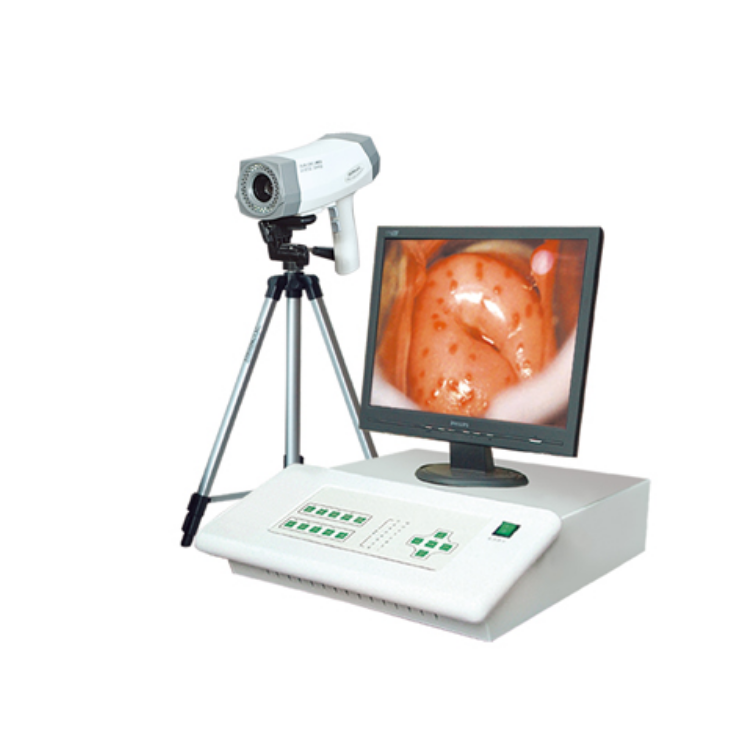 數(shù)碼電子陰道鏡 臺式陰道鏡BX-8100I、BX-8100II