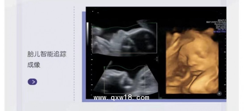 GE彩色超聲診斷儀B超儀器彩超設備美國通用