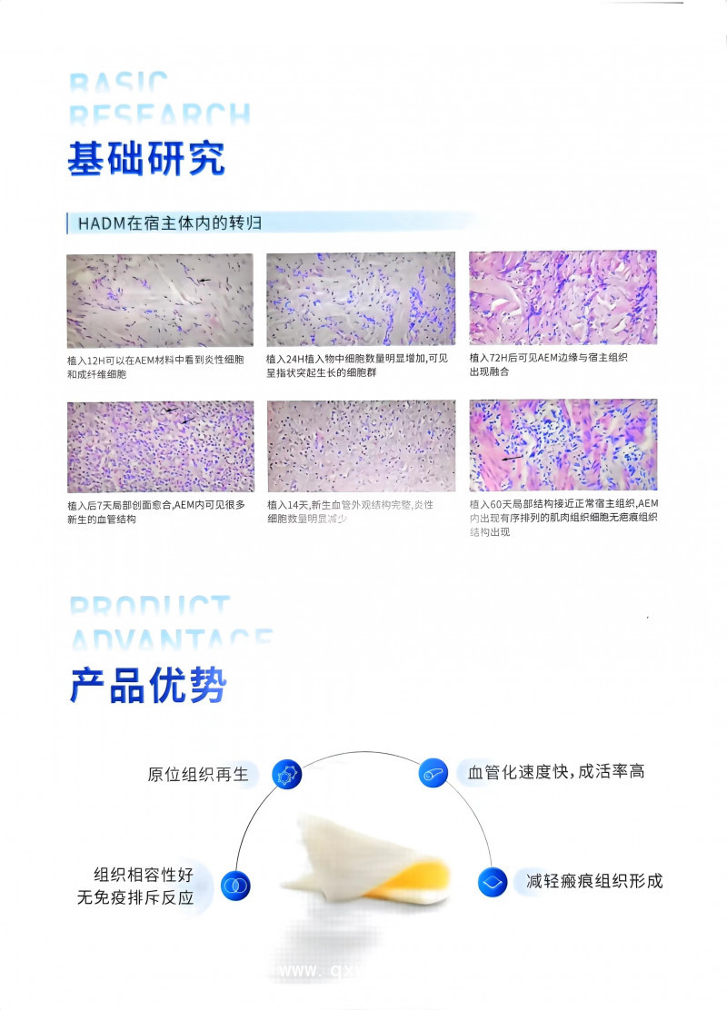 脫細胞異體真皮基質(zhì)軟組織補片