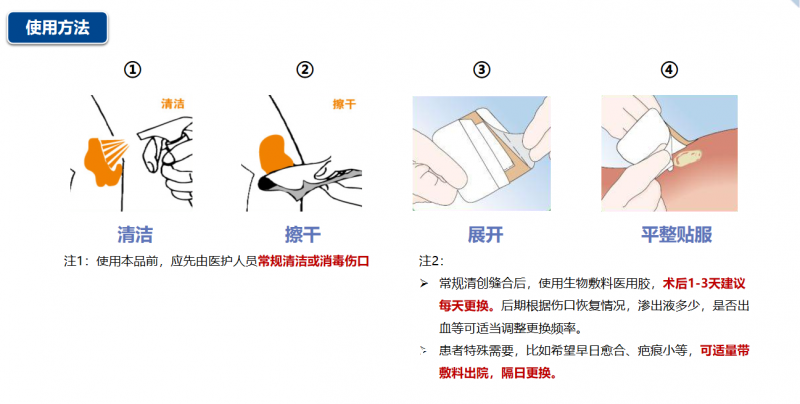 生物敷料醫(yī)用膠