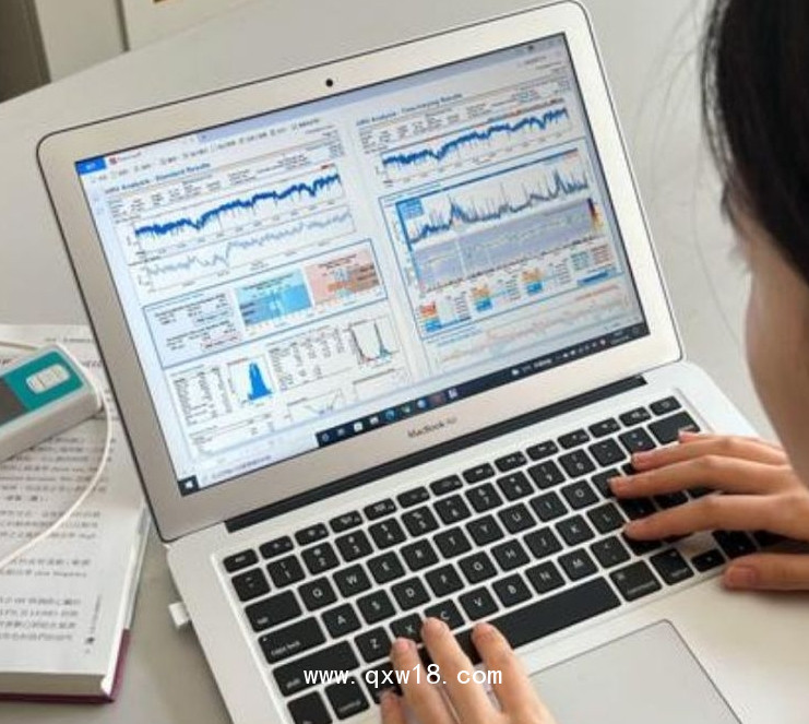 韓邁迪克醫(yī)療 心率變異分析系統(tǒng) SA-3000P 用于對心率進(jìn)行測量