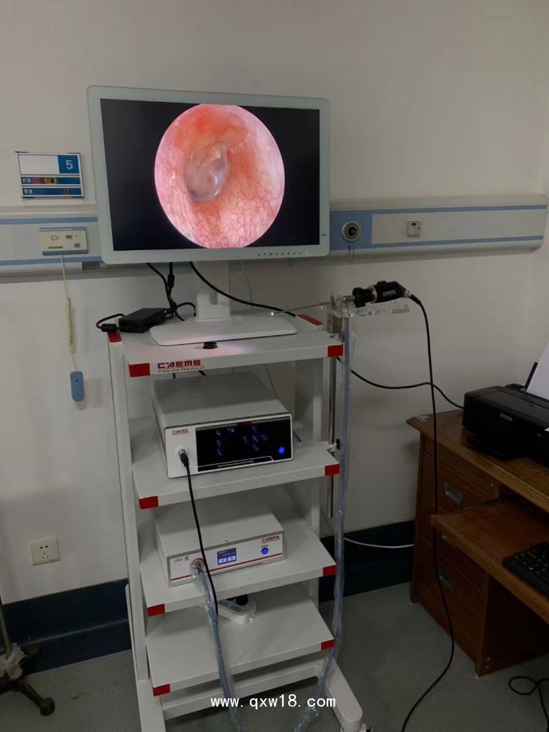 關(guān)節(jié)鏡