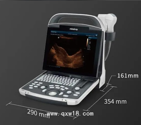 全數(shù)字便攜式超聲診斷系統(tǒng)