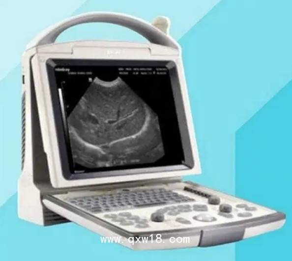 全數(shù)字便攜式超聲診斷系統(tǒng)