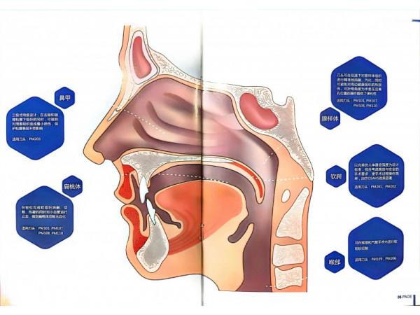 廣州帕瑪?shù)蜏氐入x子刀頭 帕瑪耳鼻喉刀頭 帕瑪關節(jié)等離子刀頭