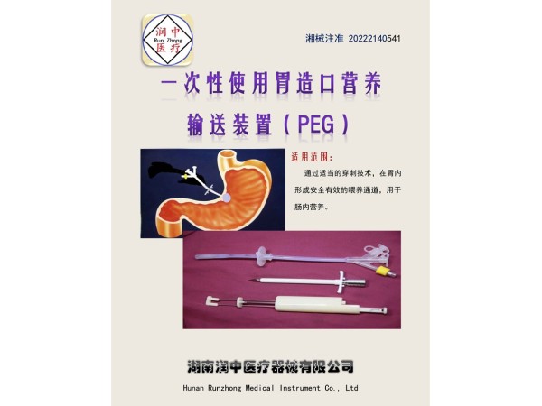 經(jīng)皮胃造瘺飼管（一次性使用胃造口營養(yǎng)輸送裝置(PEG)）