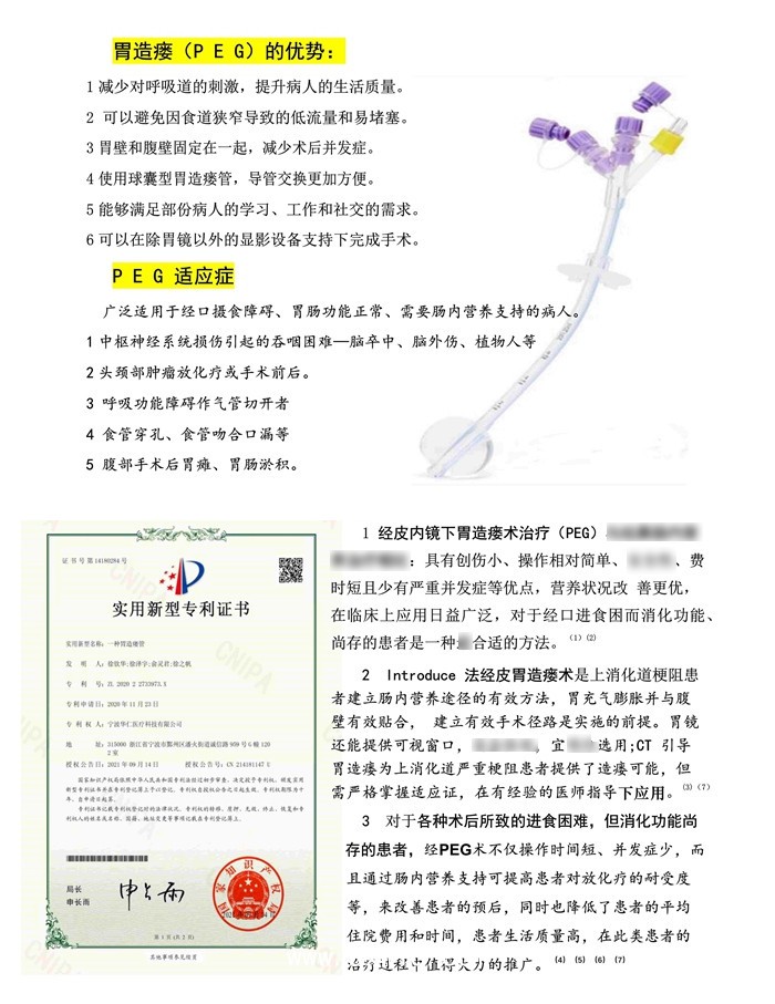 經(jīng)皮胃造瘺飼管（一次性使用胃造口營養(yǎng)輸送裝置(PEG)）