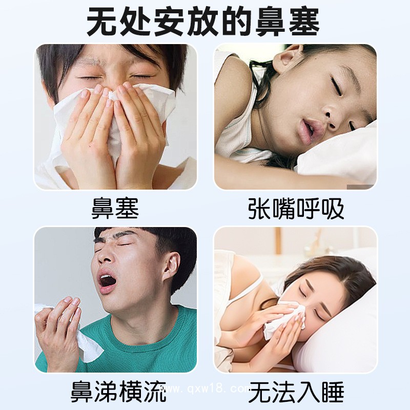 通氣鼻貼兒童成人鼻炎鼻塞通鼻神器緩解鼻子不通穴位貼代加工定制