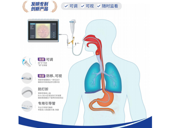 可視化鼻胃腸管