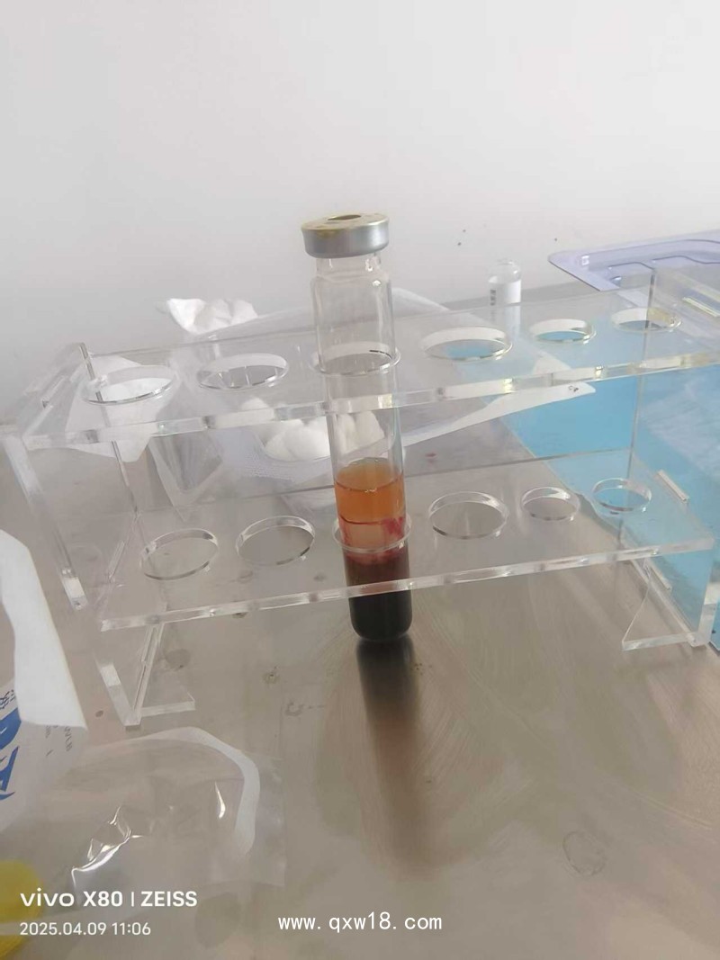 一次性使用富血小板血漿制備器 PRP濃縮液 配套PRP離心機獲取