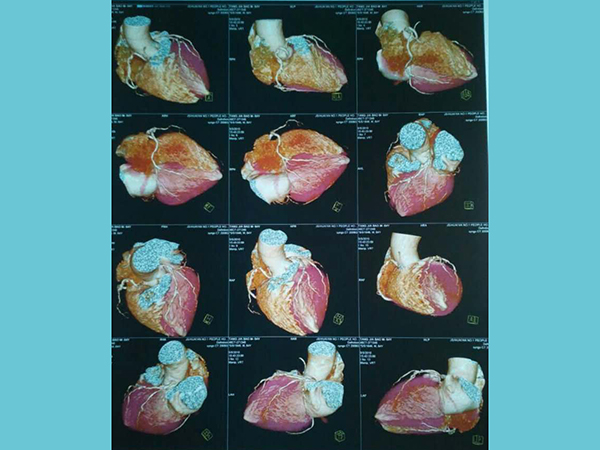 西施康牌醫(yī)用干式膠片--彩色噴墨、激光膠片