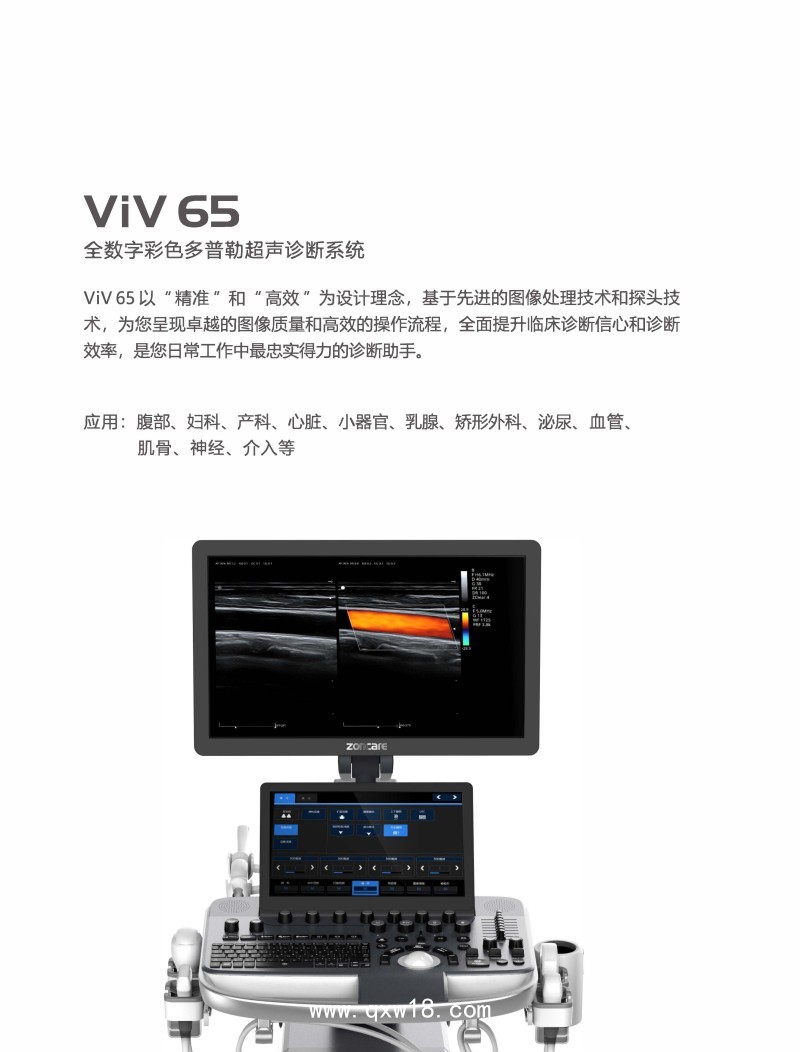 中旗 彩色多普勒超聲診斷系統(tǒng)VIV 65