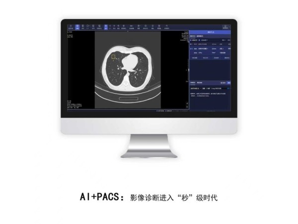 智慧PACS智慧化平臺