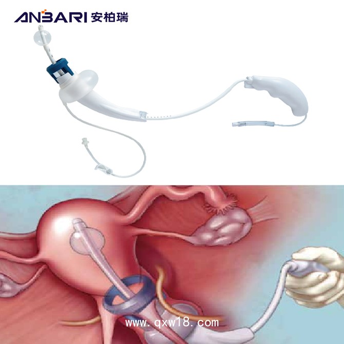 一次性使用球囊舉宮器