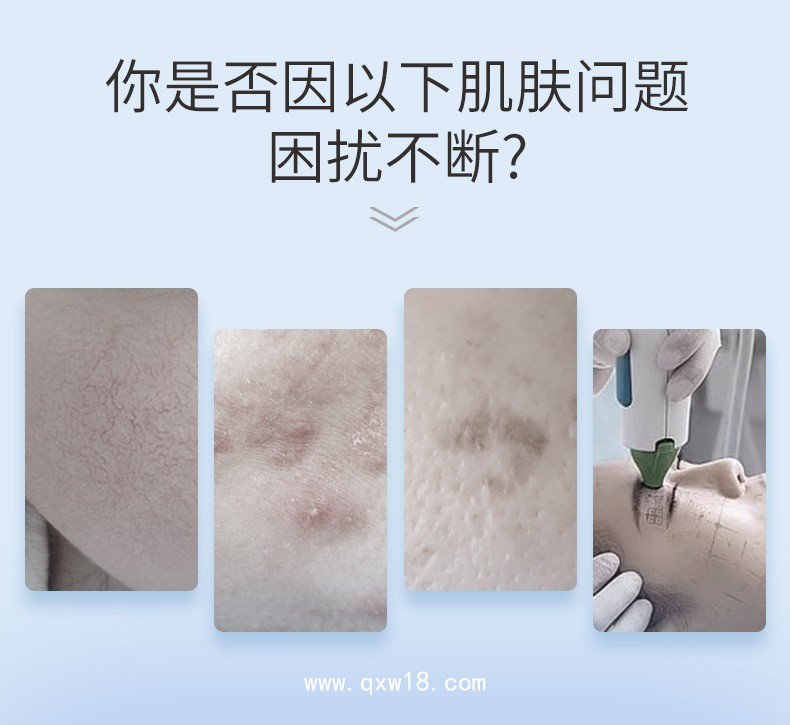 重組Ⅲ型人源化膠原蛋白敷料貼生產廠家 定制無菌械字號醫(yī)用冷敷貼