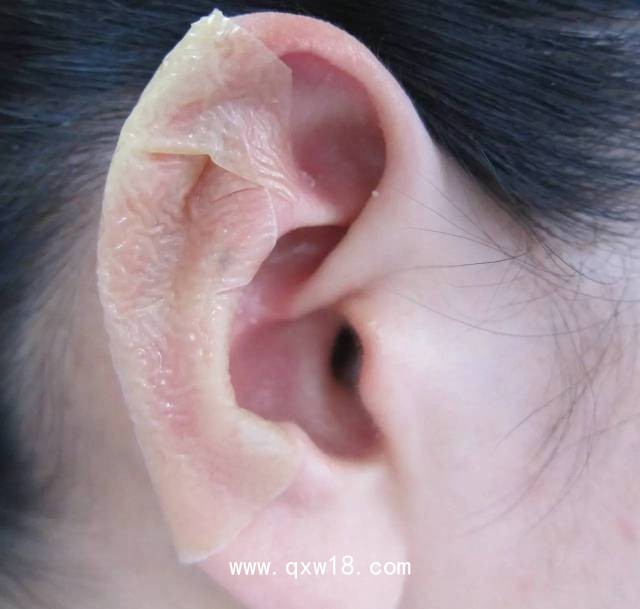 皮膚科水膠體敷料代加工 吸收滲液