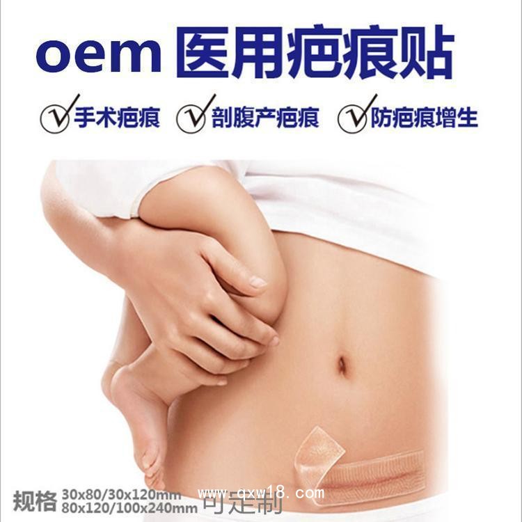 疤痕貼二類器械臨床掛網剖腹產疤痕新舊疤痕貼