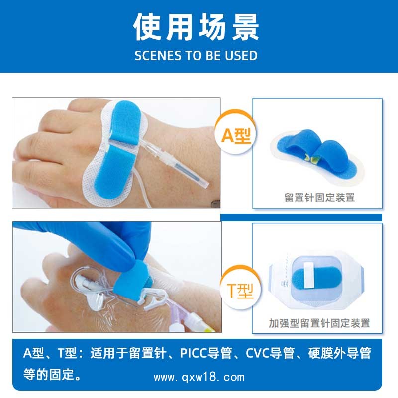 體表導(dǎo)管固定貼 固定牢靠可定制代加工