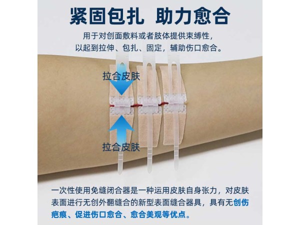 醫(yī)用免縫閉合器 減張貼 可代工