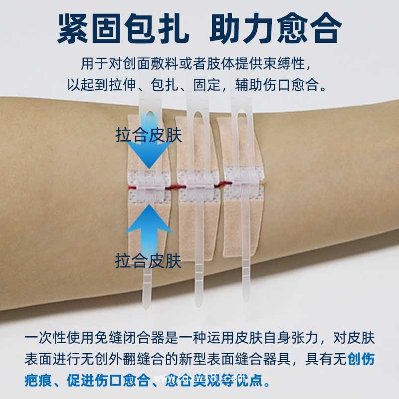 一次性使用免縫閉合器 單排多排扣 可定制