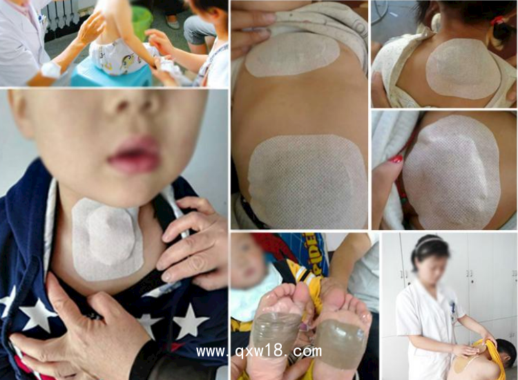 沙蒿子透皮貼含酒精藥水透皮貼膏藥載體二類械字號(hào)