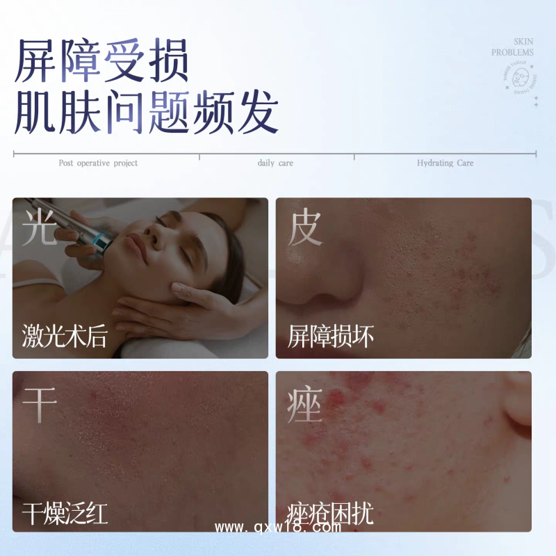 透明質(zhì)酸鈉敷料 現(xiàn)貨批發(fā)二類械字號(hào)院線非面膜醫(yī)用冷敷貼廠家