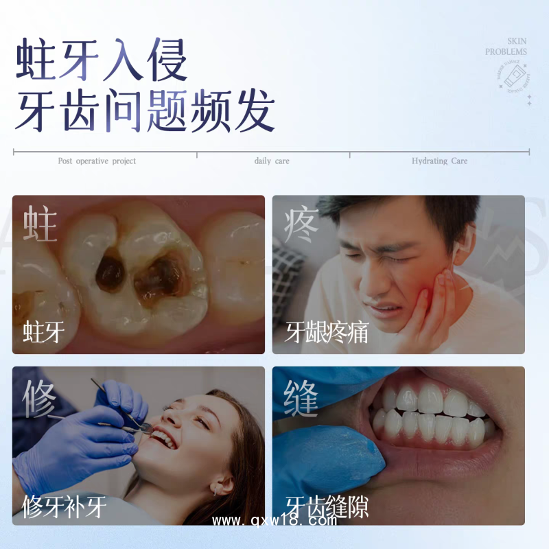 醫(yī)用口腔防蛀膏廠家 現(xiàn)貨批發(fā)二類械字號(hào)院線同款可定制益生菌牙膏