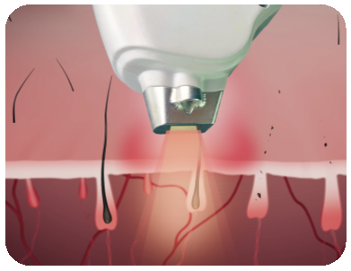 1516671235173983.png 1516671235173983.png