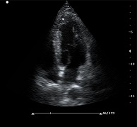 圖片關(guān)鍵詞