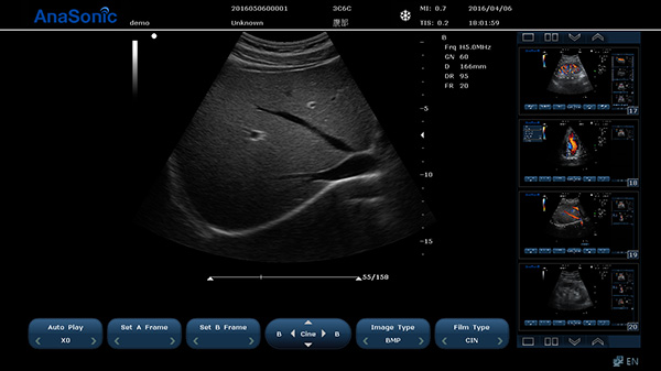 1536830410251612.jpg 圖片關(guān)鍵詞