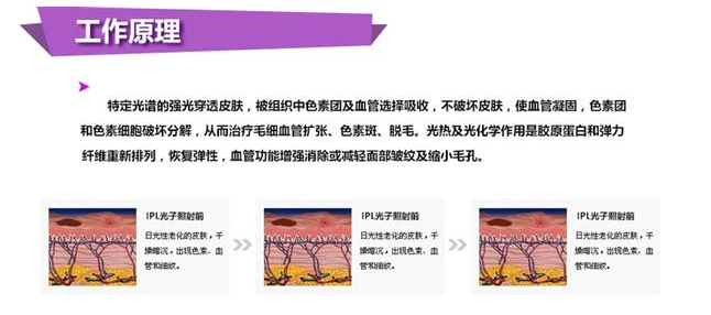 1561682476851363.jpg 工作原理.jpg