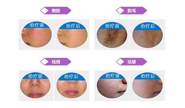 1561682506588884.jpg 治療對(duì)比.jpg