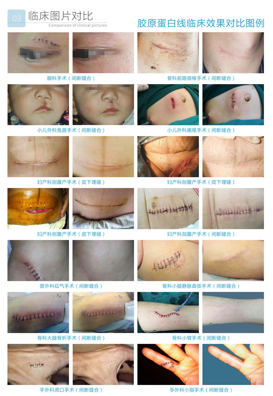 1584413513790913.jpg 3.jpg