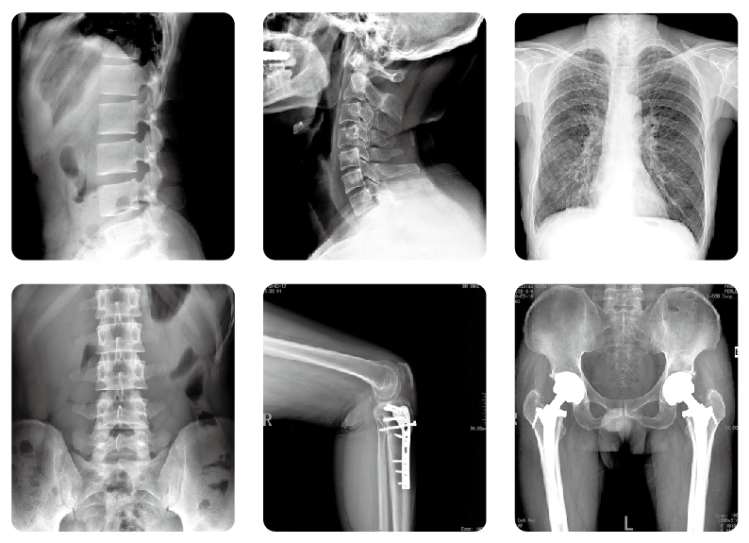 醫(yī)用X光機(jī) 醫(yī)用X光機(jī)