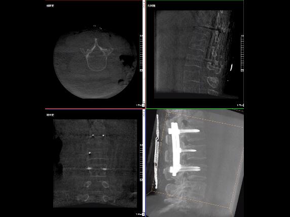 【醫(yī)療科普】2分鐘帶你了解高質(zhì)量X光片的標(biāo)準(zhǔn)是什么？