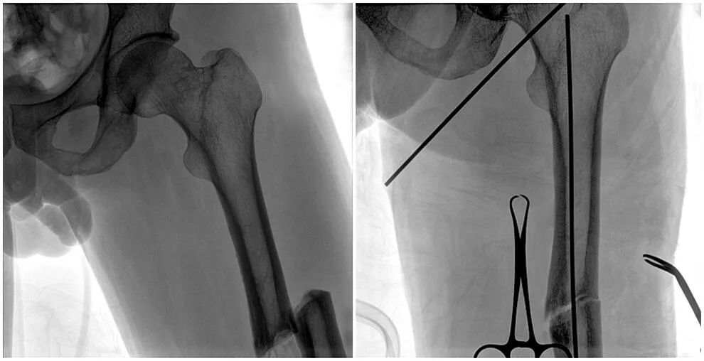 大平板一體式C形臂輔影像 大平板一體式C形臂輔影像