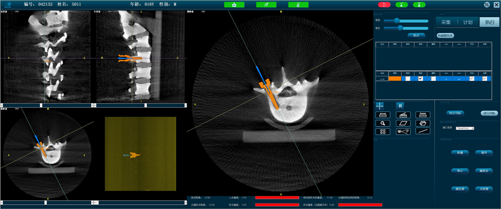天權(quán)骨科手術(shù)機器人-準確定位