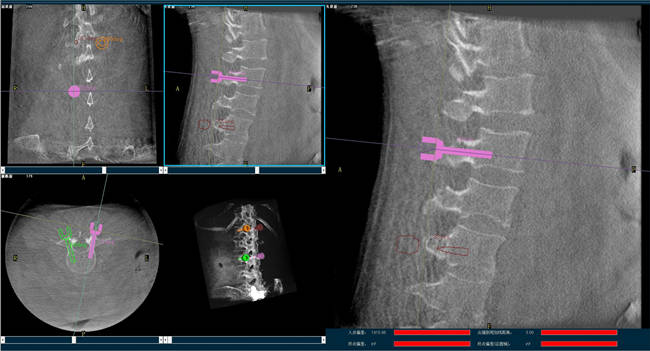 外科手術(shù)機(jī)器人規(guī)劃圖像