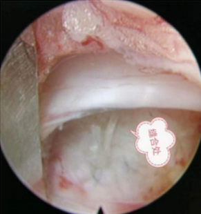 1684375674254025.png 1ebeabbfee767612f1db46147c7add9.png