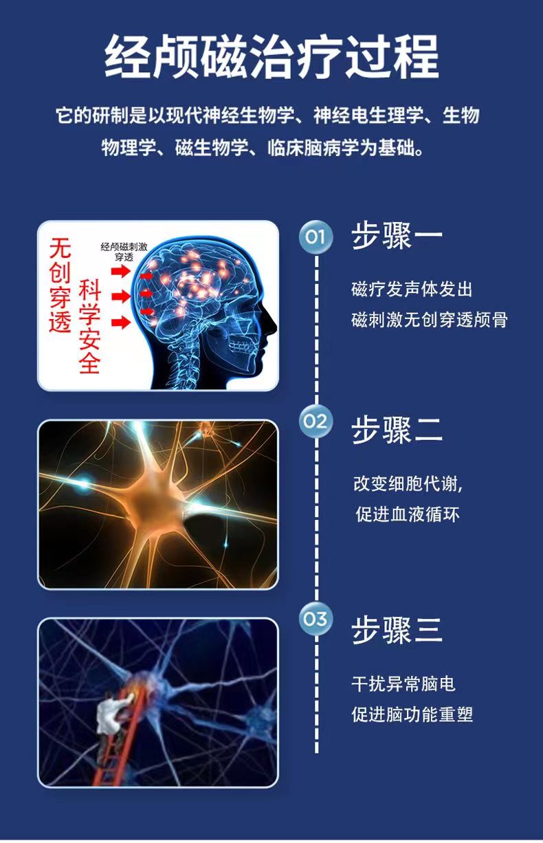 經(jīng)顱磁電療儀.jpg 經(jīng)顱磁電療儀.jpg