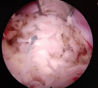 1692771951587032.png 156c6bfe86efdad7fd79eec82419c52.png