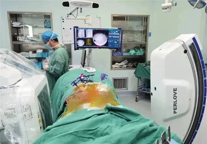 平板三維C形臂采集圖像